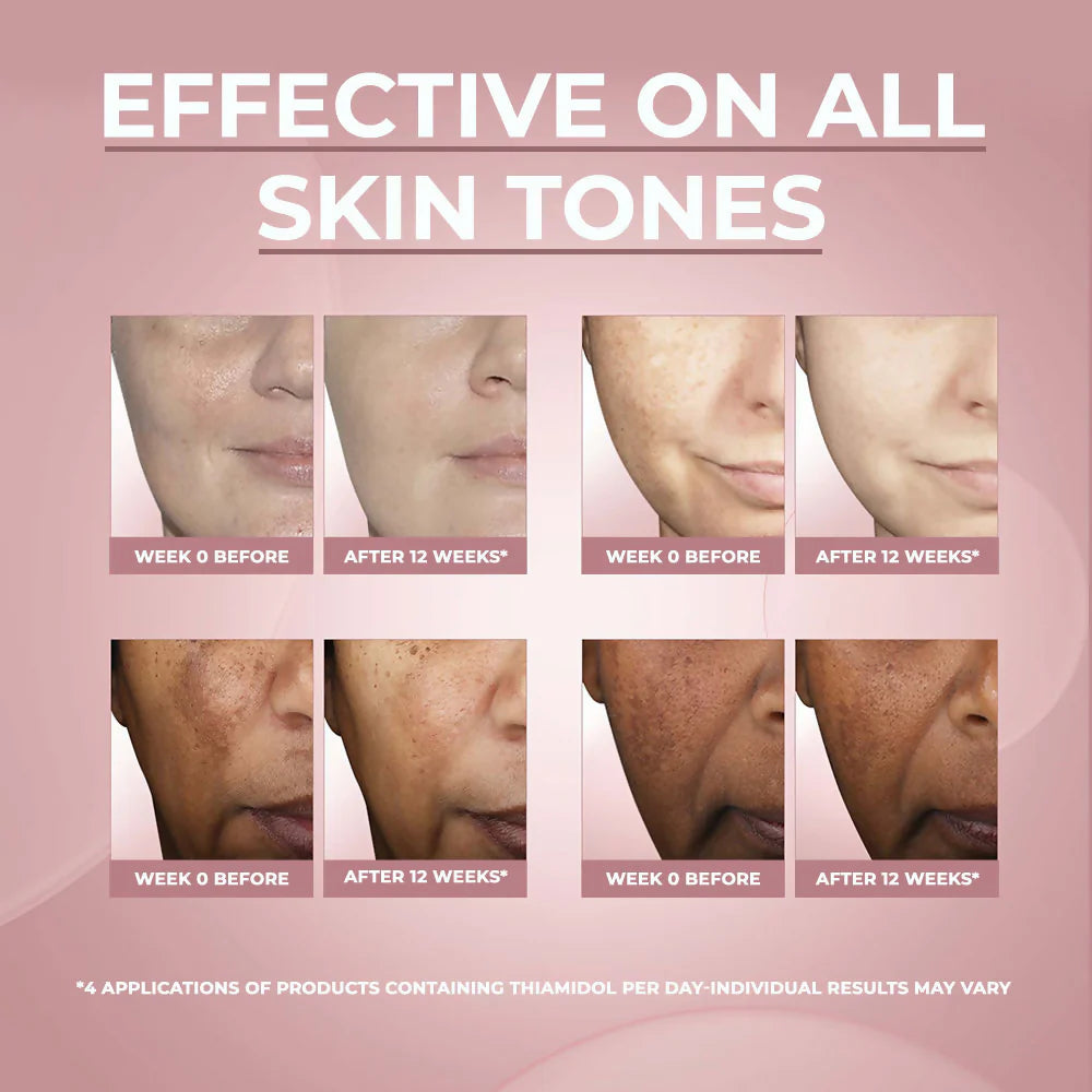 Eucerin Anti-Pigment Dual Serum With Thiamidol & Hyaluronic Acid