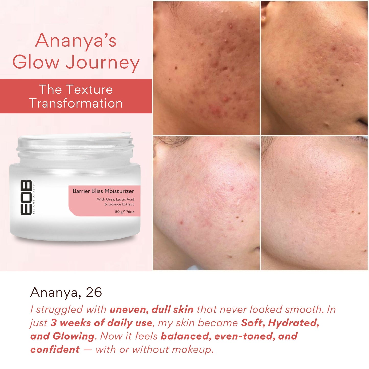 EOB Barrier Bliss Moisturizer