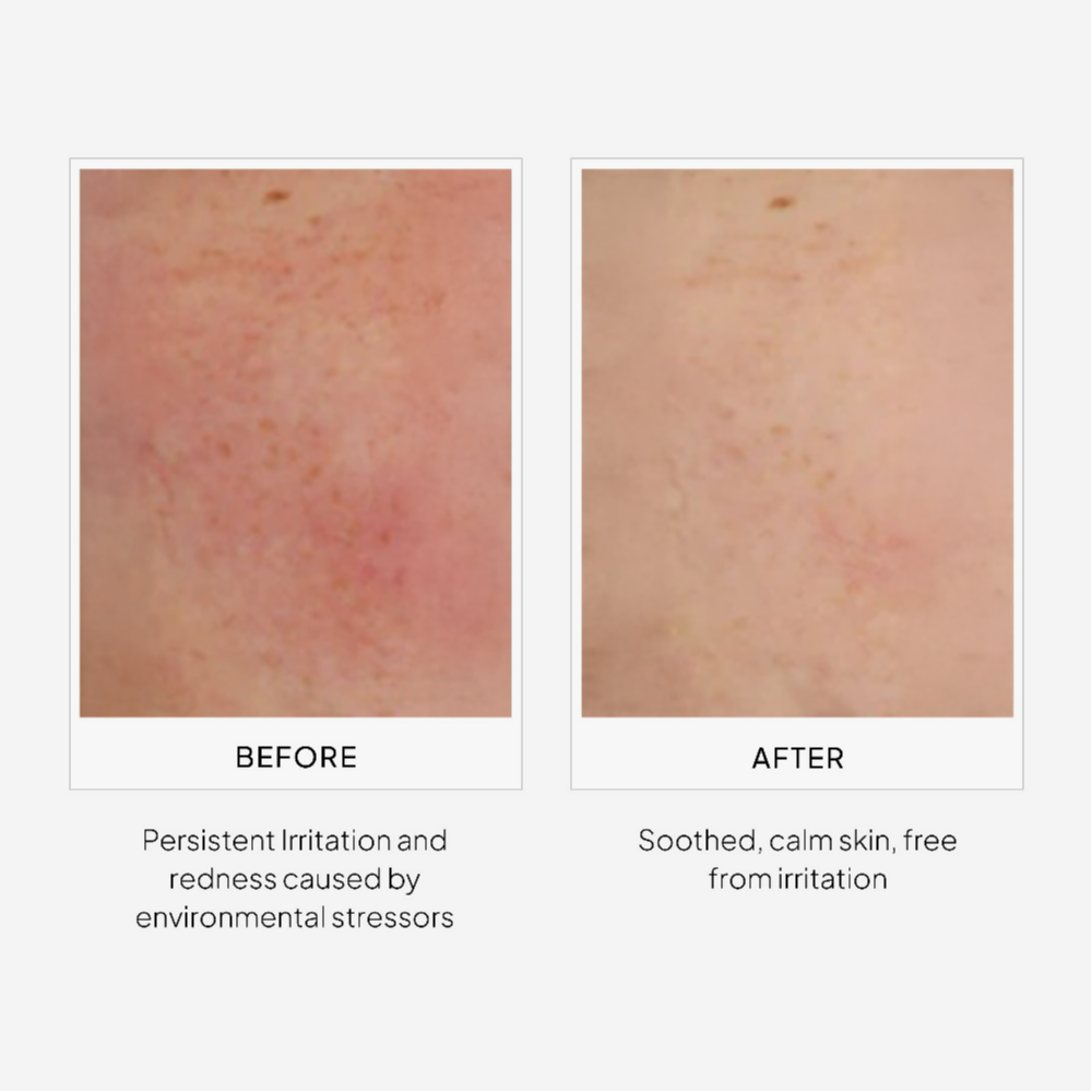 Miduty by Palak Notes EpiShield Day Serum